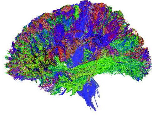 Colorful mapping of the brain.
